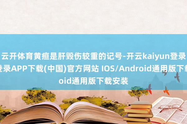 云开体育黄疸是肝毁伤较重的记号-开云kaiyun登录入口登录APP下载(中国)官方网站 IOS/Android通用版下载安装